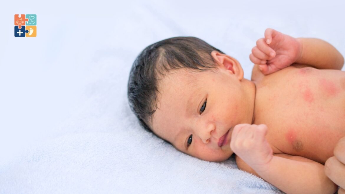 What Causes a Newborn Baby's Rash? Exploring The Different Causes And Remedies